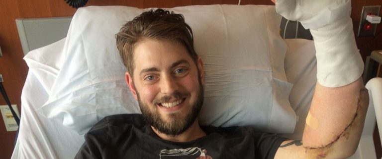 Marine who had double arm transplant to return to Villages to say ‘thank you’ 