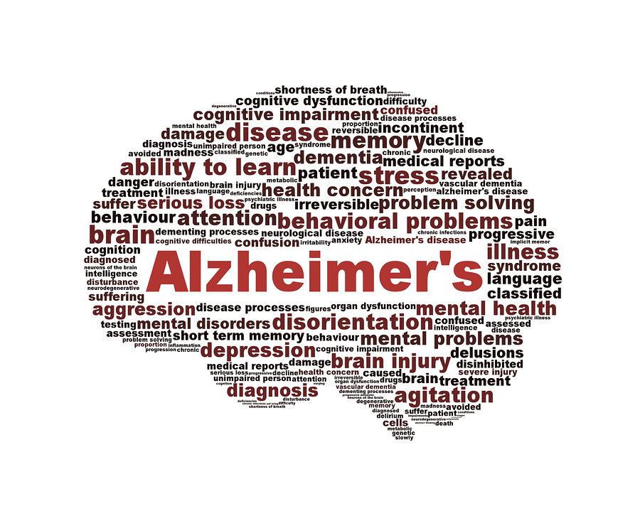 Image result for alzheimer's disease