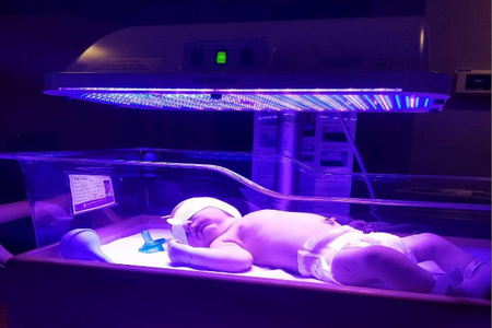 Hospital use LED to treat infants born with jaundice