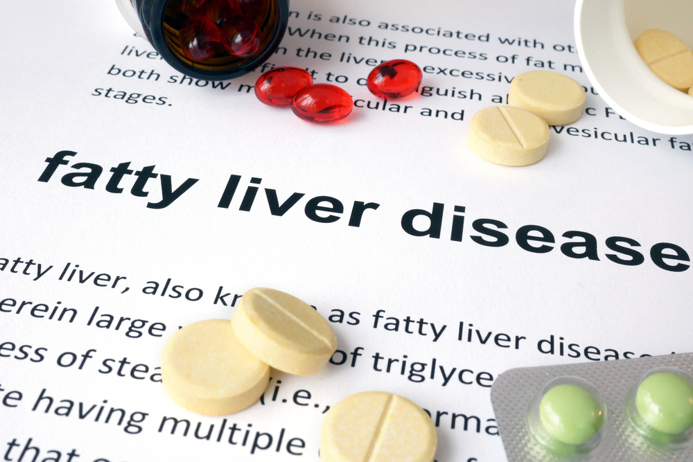 fatty liver