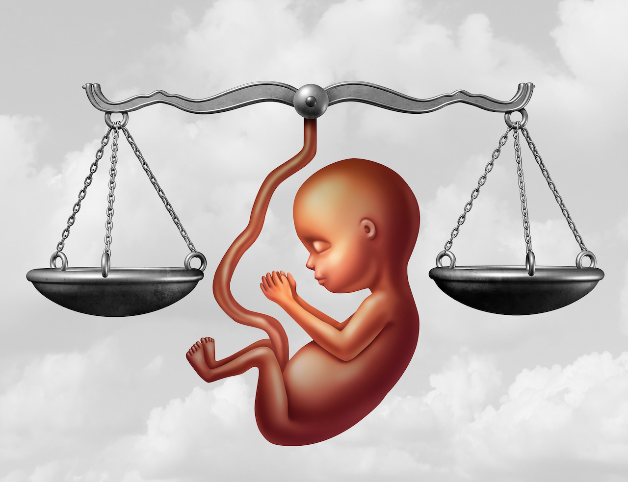abortion law