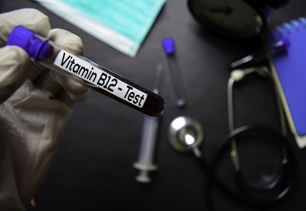 Vitamin B12 Test with blood sample. Top view isolated on black background. Healthcare/Medical concept