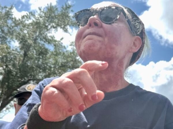 Villager convicted in attack on MAGA leader to enter special treatment program