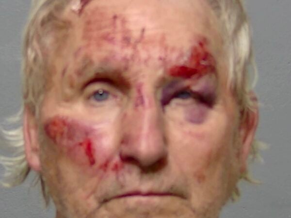 Ohio man injured and arrested after crashing golf cart into fence in The Villages