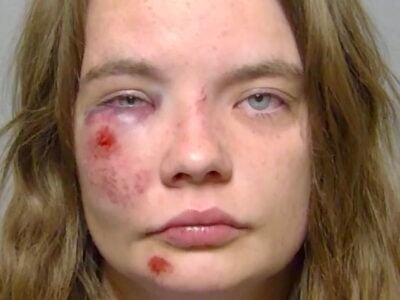 Woman mum on details after nasty fall from golf cart
